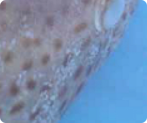 Prevention and Control of Monogenean Parasites in Fish